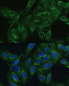 Immunofluorescence analysis of U2OS cells using Anti-FRMD6/Willin Antibody (A12445) at a dilution of 1:100 DAPI was used to stain the cell nuclei (blue)