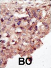 Anti-DAPK2 Rabbit Polyclonal Antibody