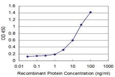 Anti-DEGS1 Mouse Monoclonal Antibody [clone: 2E9]