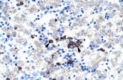 Anti-ABT1 Rabbit Polyclonal Antibody