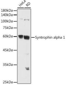 Anti-Syntrophin alpha 1 Rabbit Polyclonal Antibody