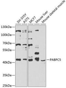 Western blot analysis of extracts of various cell lines, using Anti-polyclonal antibodyPC5 Antibody (A12446) at 1:1,000 dilution