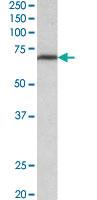 Anti-MTHFR Goat Polyclonal Antibody