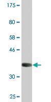 Anti-SPP1 Mouse Monoclonal Antibody [clone: 4C4]