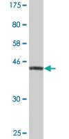 Anti-NDUFS3 Mouse Monoclonal Antibody [clone: 1D6]