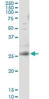 Anti-RAB3B Antibody Pair