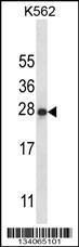 Anti-IL22 Rabbit Polyclonal Antibody (AP (Alkaline Phosphatase))