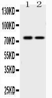 Anti-KCNQ1 Rabbit Polyclonal Antibody