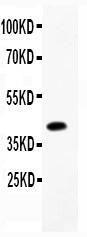 Anti-CBS Polyclonal Antibody