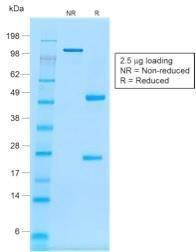 SDS-PAGE analysis of Anti-CD20 Antibody [rIGEL/773] under non-reduced and reduced conditions; showing intact IgG and intact heavy and light chains, respectively. SDS-PAGE analysis confirms the integrity and purity of the antibody