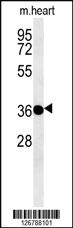 Anti-PTAFR Rabbit Polyclonal Antibody