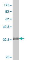 Anti-MSRB1 Mouse Monoclonal Antibody [clone: 8B2]