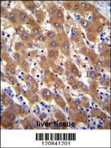 Anti-IRGM Rabbit Polyclonal Antibody (AP (Alkaline Phosphatase))