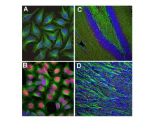 Analyse de l'expression c-Fos en culture de cellules HeLa par immunocytochimie (A-B), et sur des sections d'hippocampe de souris (C) ou de bulbe olfactif (D) par immunohistochimie.