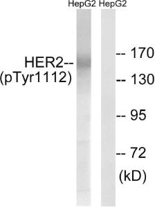 Western blot analysis of lysates from HepG2 cells treated with PMA 125ng/ml 20' using Anti-HER2 (phospho Tyr1112) Antibody. The right hand lane represents a negative control, where the antibody is blocked by the immunising peptide.