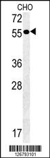 Anti-AMY2A Rabbit Polyclonal Antibody