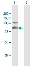 Anti-ITGB7 Rabbit Polyclonal Antibody