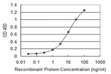 Anti-CORO1C Mouse Monoclonal Antibody [clone: 1F7]