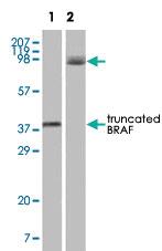 Anti-BRAF Mouse Monoclonal Antibody [clone: 1H12F1,1H12G10,1F12F11C9]