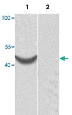 Anti-ACTR1B Rabbit Polyclonal Antibody