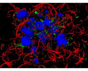 Coloration des plaques amyloïdes (bleu) dans le cerveau de la souris adulte hétérozygote ligne J20. 