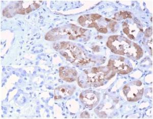 Immunohistochemical analysis of formalin-fixed, paraffin-embedded human kidney using Anti-FGF23 Antibody [FGF23/4174] at 2 µg/ml in PBS for 30 minutes at room temperature. Inset: PBS instead of the primary antibody. Secondary antibody negative control