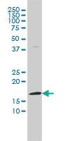 Anti-FHIT Mouse Monoclonal Antibody [clone: 1E3]