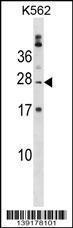 Anti-PABPC1L2B Rabbit Polyclonal Antibody (APC (Allophycocyanin))