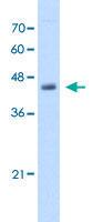 Anti-ADH1B Rabbit Polyclonal Antibody