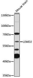 Western blot analysis of extracts of mouse brain, using Anti-LEMD2 Antibody (A308136) at 1:1,000 dilution