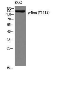 Western blot analysis of K562 using Anti-HER2 (phospho Tyr1112) Antibody