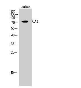 Anti-PJA2 antibody