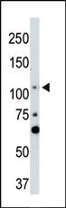 Anti-LATS2 Rabbit Polyclonal Antibody