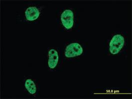 Anti-CDX1 Mouse Monoclonal Antibody [clone: 3A3]