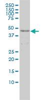 Anti-DAPK2 Mouse Monoclonal Antibody [clone: 3D4]