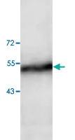 Anti-ADAM15 Rabbit Polyclonal Antibody