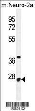 Anti-CF153 Rabbit Polyclonal Antibody (FITC (Fluorescein Isothiocyanate))