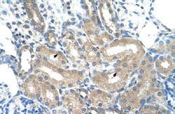 Anti-ADH1B Rabbit Polyclonal Antibody