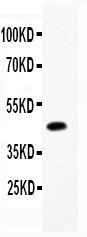 Anti-CD79b Polyclonal Antibody