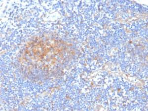 Antibody anti-AKR1C1 CPTC-AKR1C1-2 100 µg