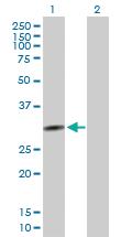 Anti-QPCTL Mouse Polyclonal Antibody