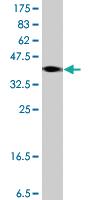 Anti-RNF139 Mouse Polyclonal Antibody