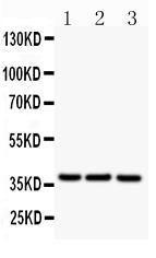 Anti-CD79b Polyclonal Antibody