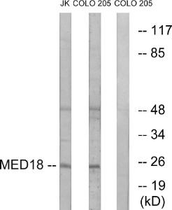 Western blot analysis of lysates from COLO and Jurkat cells using Anti-MED18 Antibody The right hand lane represents a negative control, where the antibody is blocked by the immunising peptide