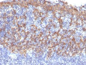 Immunohistochemical analysis of formalin-fixed, paraffin-embedded human tonsil using Anti-Cytokeratin 14 Antibody [LL002]