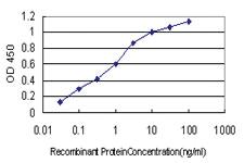 Anti-FHIT Mouse Monoclonal Antibody [clone: 1E3]