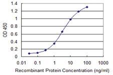 Anti-DAPK2 Mouse Monoclonal Antibody [clone: 3D4]