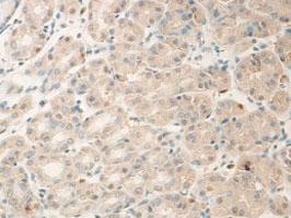 Anti-ADAM15 Rabbit Polyclonal Antibody