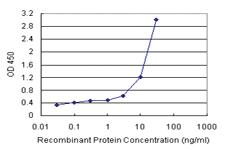 Anti-TRIM16 Polyclonal Antibody Pair