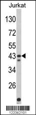 Anti-TM4SF18 Rabbit Polyclonal Antibody